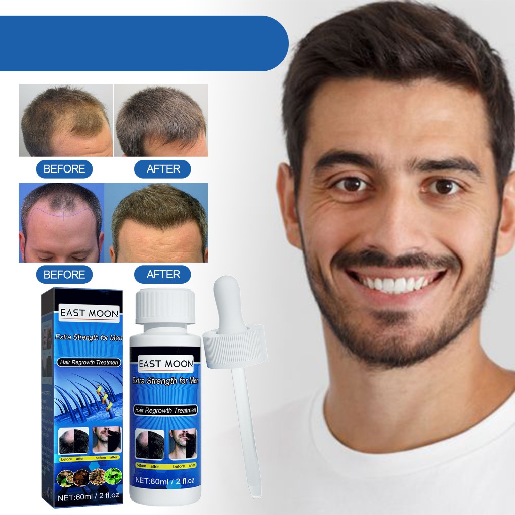 1 Tinh Chất Kirkland Minoxidil 60ML Kích Thích Mọc Râu Cho Nam Giới