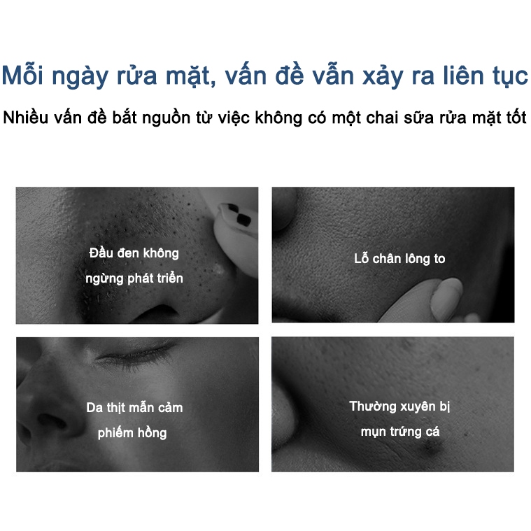 Sữa rửa mặt axit amin YIMIAOSI 500g