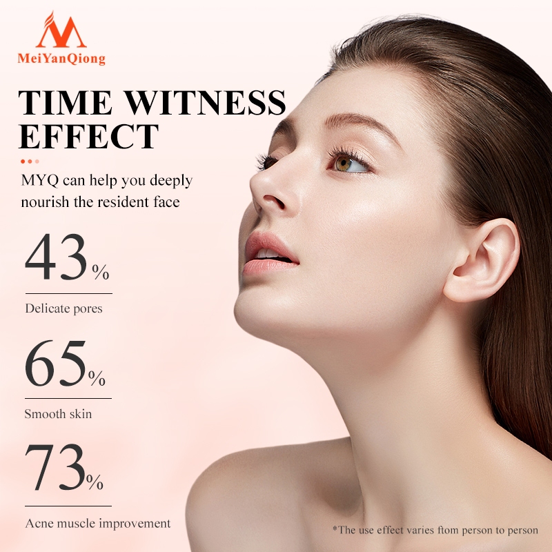Kem dưỡng Hỗ Trợ Giảm Mụn MeiYanQiong cải thiện da thô ráp xỉn màu làm sáng màu da chăm dưỡng trắng 15g