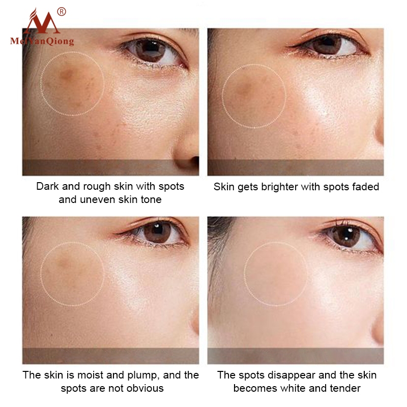 Kem dưỡng sáng da MeiYanQiong Kem Xóa Nám Làm Trắng Da Mặt Dưỡng Ẩm Làm mờ nếp nhăn Phục Hồi Làm Trắng Sáng Da Mờ Thâm Sạm Nám Cấp Nước 40g