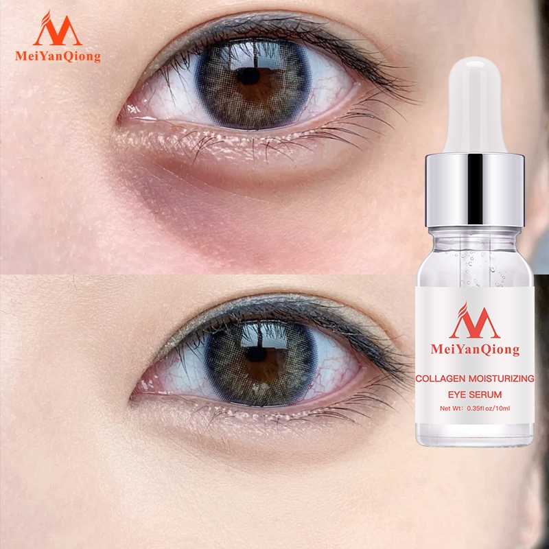 MeiYanQiong Tái TạoTinh Chất Dưỡng Da Vùng Mắt Chống Lão Hóa Loại Bỏ Nếp Nhăn Rejuvenating eye Serum12ml