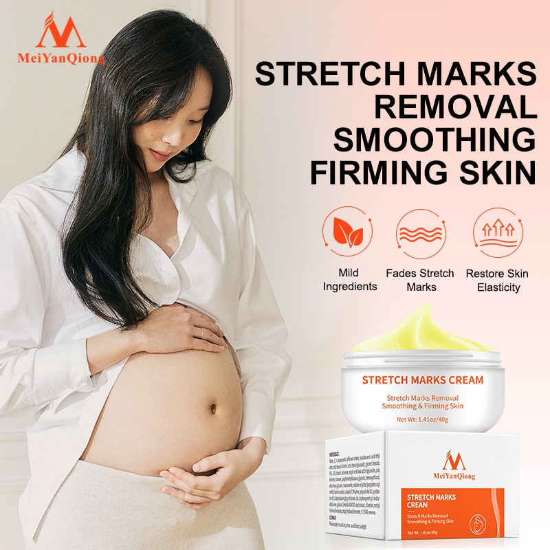 Meiyanqiong Stretch Mark Cream Làm Trắng Và Săn Chắc Mịn Mượt Chống Lão Hóa Giảm rạn da Kem dưỡng ẩm 35g