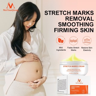 MeiYanQiong Stretch Mark Cream Làm Trắng Và Săn Chắc Mịn Mượt Chống Lão Hóa Giảm rạn da Kem dưỡng ẩm 35g