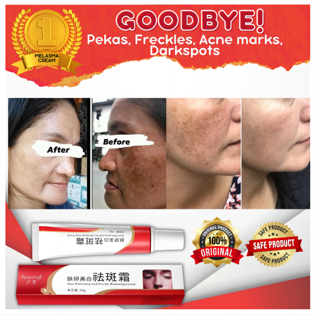 Kem dưỡng trắng da loại bỏ vết thâm và tàn nhang hiệu quả 20g