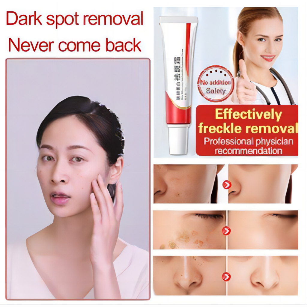 Kem dưỡng trắng da loại bỏ vết thâm và tàn nhang hiệu quả 20g