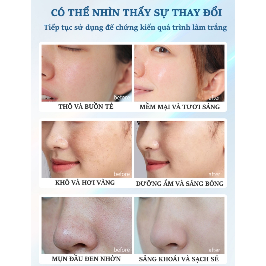 Sữa Rửa Mặt Trắng Da 150g Sữa Rửa Mặt cho da dầu mụn Trắng da ngừa mụn Làm sạch sâuTẩy tế bào chết, phục hồi đa chức năng