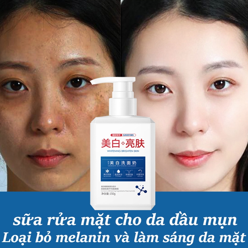 Sữa Rửa Mặt Trắng Da 150g Sữa Rửa Mặt cho da dầu mụn Trắng da ngừa mụn Làm sạch sâuTẩy tế bào chết, phục hồi đa chức năng