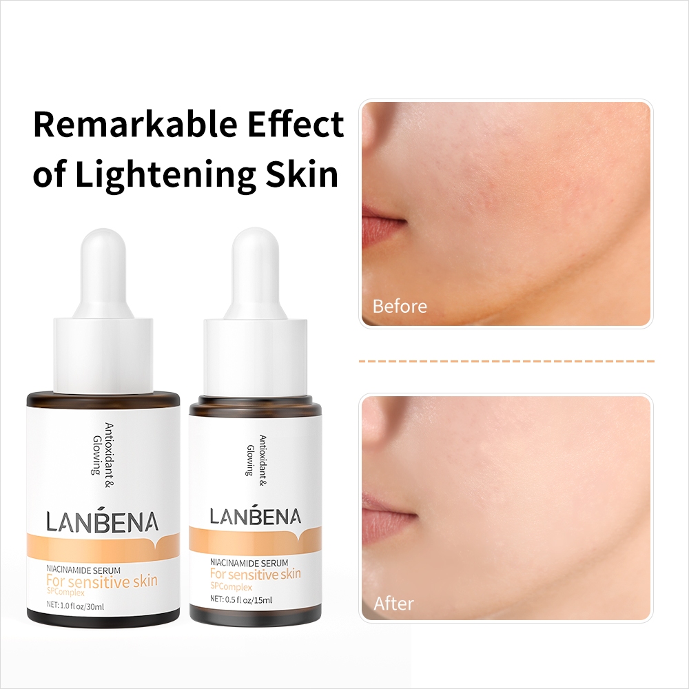 [Shopee Live] Serum Niacinamide Lanbena Làm Trắng Sáng Làn Da 15ml 30ml