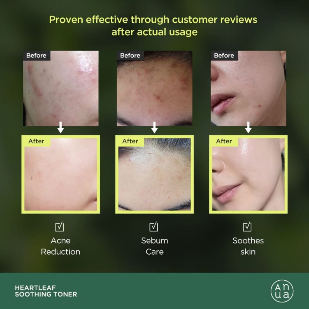Anua 77 Toner Anua 77% diếp cá làm dịu, dưỡng da Anua Heartleaf 77% Soothing Toner nước hoa hồng 250ml Konvy
