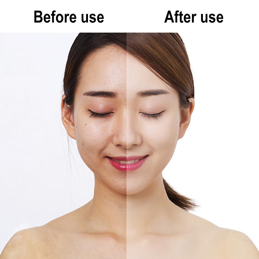 Mặt Nạ Vàng Retinol Làm Sạch Lỗ Chân Lông Mặt Moisturizin HHMBB0035