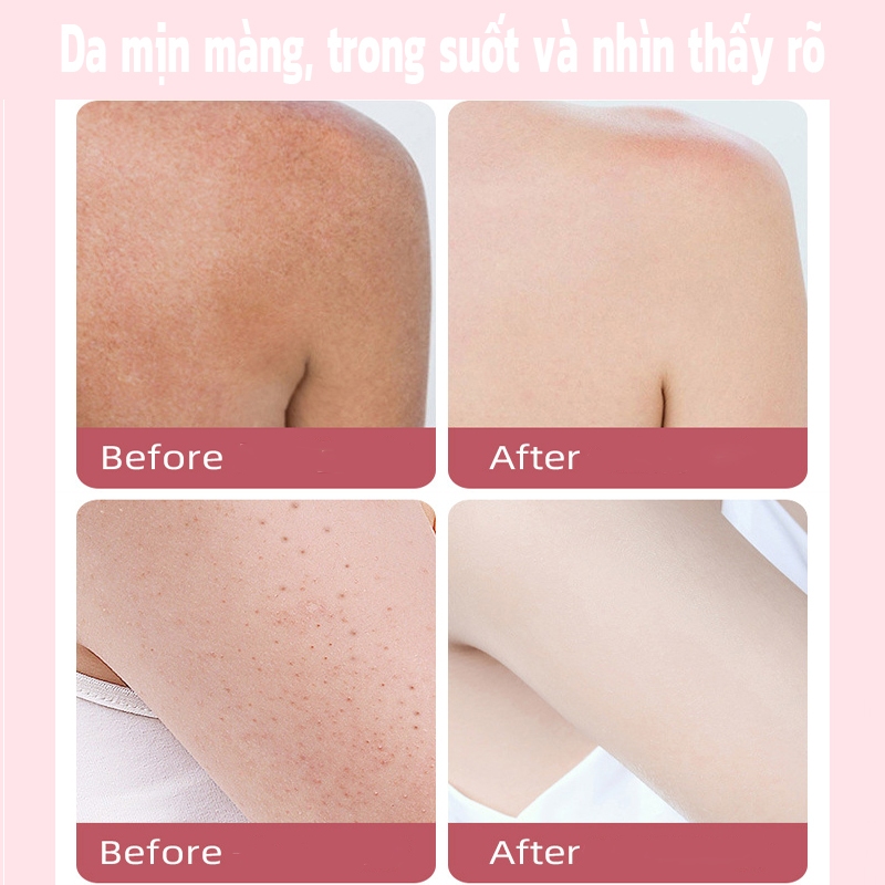 Tẩy tế bào chết  Kem tẩy tế bào chết Gel Tẩy Tế Bào Chết Làm Trắng Da 250g Tẩy Tế Bào Chết Toàn Thân Sạch Sâu và Trắng Da