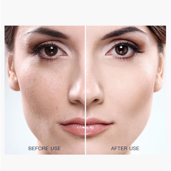 Tinh Chất hyaluronic acid Dưỡng Ẩm Se Khít Lỗ Chân Lông