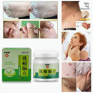 Kem trị mụn cóc, kem trị mụn cóc, kem trị mụn cóc, kem trị mụn cóc, tay, chân, mặt, nách, thớ thịt, cổ, dạng sợi, lòng bàn chân và thuốc mỡ sắc nhọn thông thường.