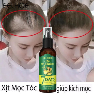 Tinh Dầu Mọc Tóc Tinh Chất Mọc Tóc Gừng Tinh Chất Mọc Tóc Chống Rụng Tóc 50ml Kích thích mọc tóc nhanh chóng, ngăn ngừa rụng tóc