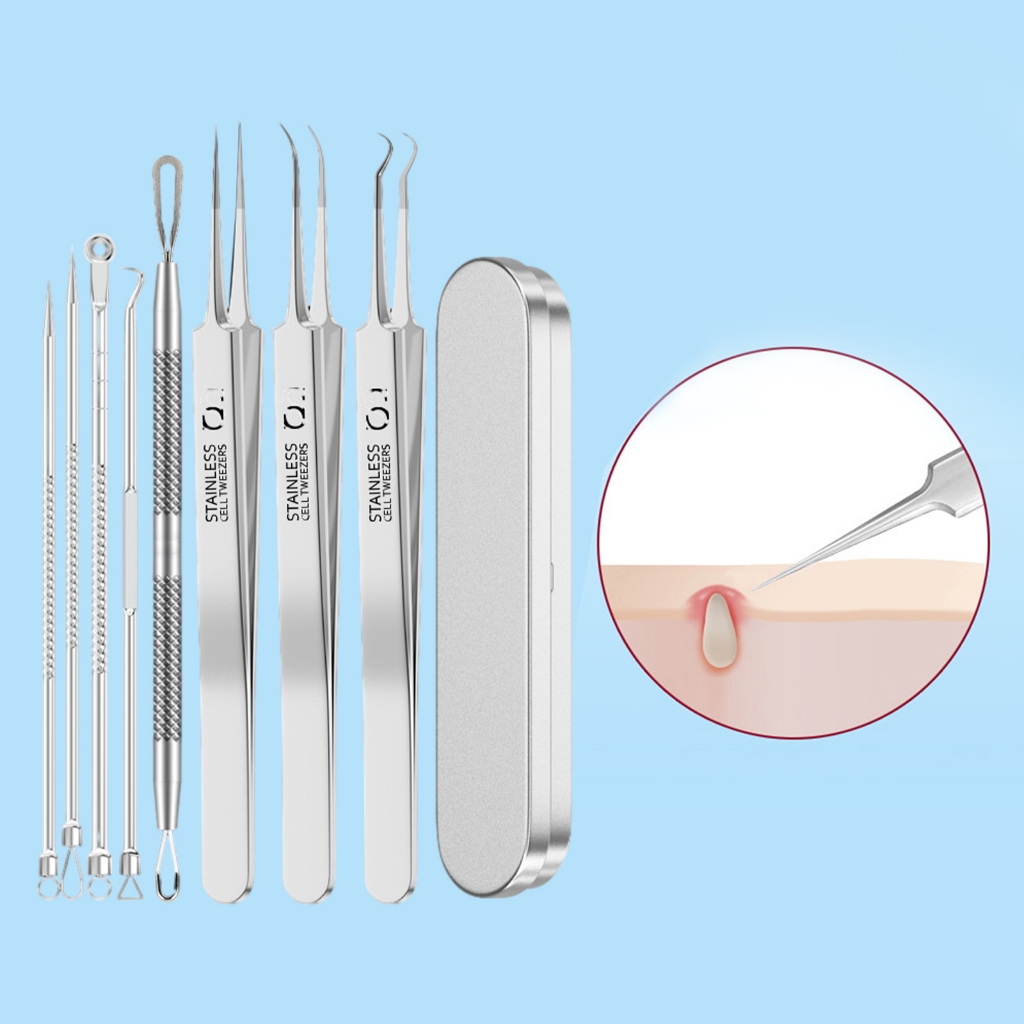 Bộ 8 Nhíp Kẹp Loại Bỏ Mụn Cóc Cho Nữ