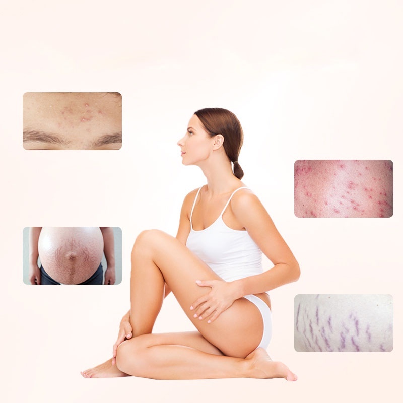 Dầu rạn da B1o O1l 200ml