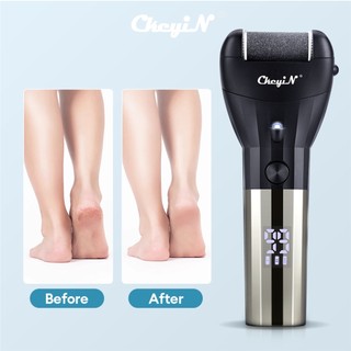 Máy chà gót chân, mài gót chân Enchen CkeyiN tẩy tế bào ch.ết làm mềm sáng gót chân chuyên dụng tại nhà