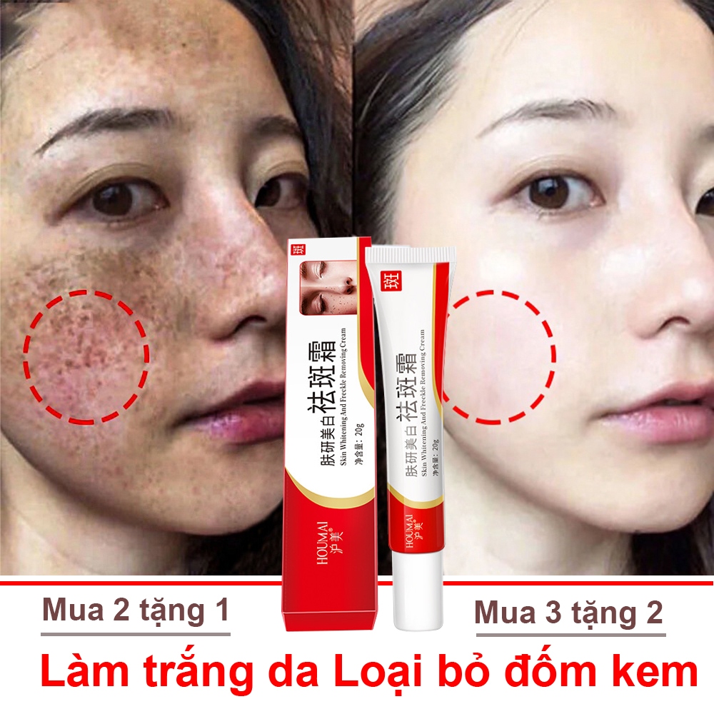 Kem làm trắng Loại bỏ các đốm đen lão hóa Sắc tố làm sáng da Chăm sóc da Phụ nữ Loại bỏ các đốm kem chống nắng Màu da không đều Làm trắng da Chăm sóc da