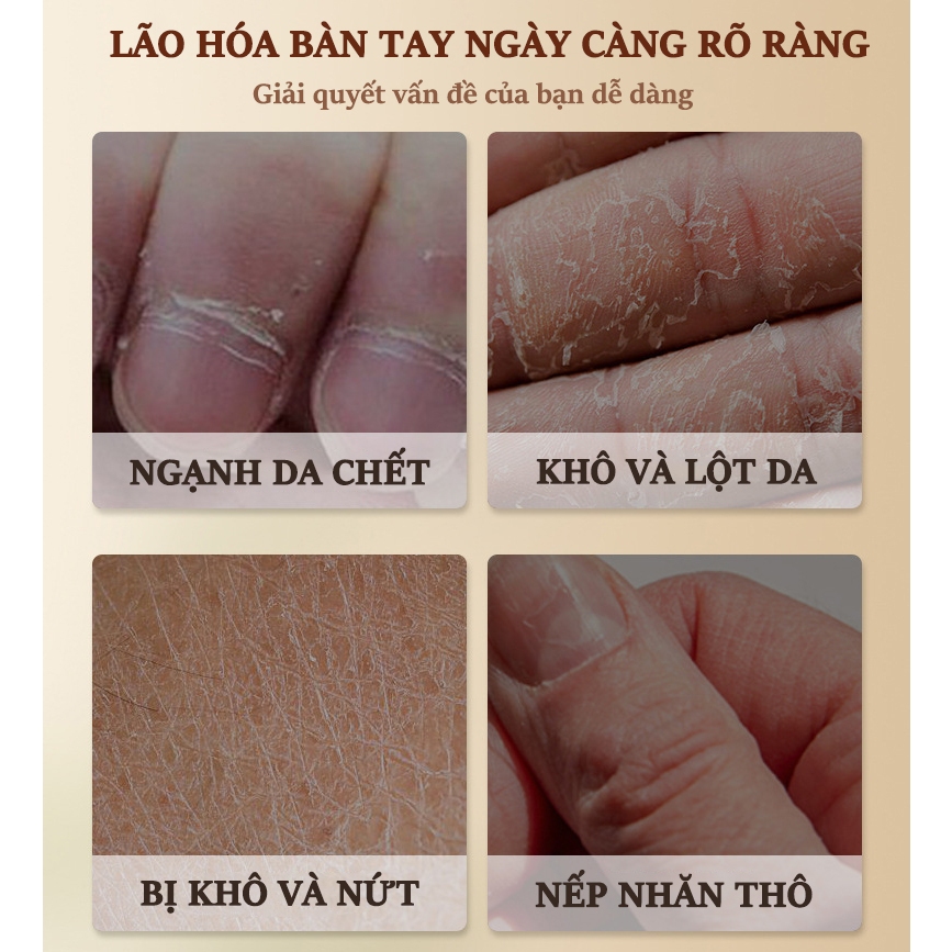 Kem dưỡng da tay Kem làm trắng tay 300g phục hồi da chân tay dưỡng ẩm da ngừa khô da nứt nẻ xóa nếp nhăn làm trắng nhanh