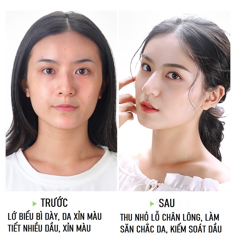 Tẩy Tế Bào Chết LAIKOU Matcha Peeling Gel Làm Sáng Da, Sạch Sâu, Loại Bỏ Hoàn Toàn Bụi Bẩn Và Dầu Thừa, Dưỡng Ẩm Và Làm Mịn Da, Thu Nhỏ Lỗ Chân Lông 60g