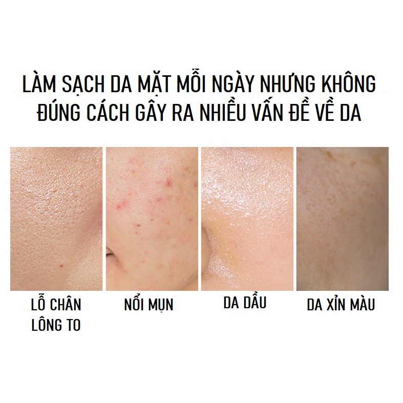 Tẩy Tế Bào Chết LAIKOU Matcha Peeling Gel Làm Sáng Da, Sạch Sâu, Loại Bỏ Hoàn Toàn Bụi Bẩn Và Dầu Thừa, Dưỡng Ẩm Và Làm Mịn Da, Thu Nhỏ Lỗ Chân Lông 60g