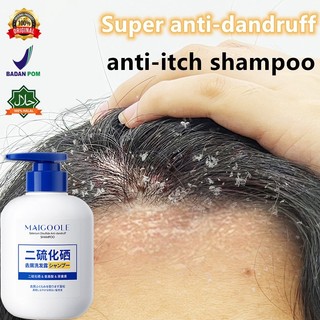 ⭐CHÍNH HÃNG⭐dầu gội sạch gàu Dầu Gội gội loại bỏ mạt dầu gội giảm ngứa 300ml Làm sạch sâu da đầu, loại bỏ ve, loại bỏ gàu và giảm ngứa