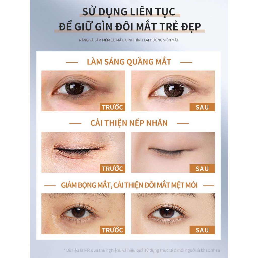 Kem mắt DELEVENTH Caffeine Ceramide giảm quầng thâm và bọng mắt hiệu quả làm căng vùng mắt 18g | BigBuy360 - bigbuy360.vn