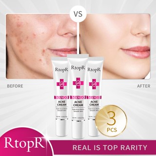  Kem Giảm Mụn Rtopr Chiết Xuất Xoài Dưỡng Ẩm Thu Nhỏ Lỗ Chân Lông Và Làm Trắng Da 15g*3 