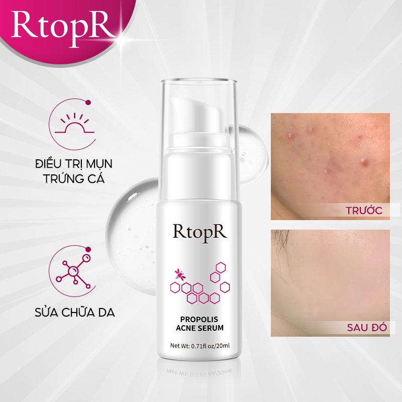 Serum hỗ trợ trị Mụn Trứng RtopR 20ml Giảm Vết Thâm Thu Nhỏ Lỗ Chân Lông Tăng Cường Và Phục Hồi Sâu