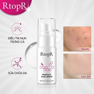 Serum hỗ trợ trị Mụn Trứng RtopR 20ml Giảm Vết Thâm Thu Nhỏ Lỗ Chân Lông Tăng Cường Và Phục Hồi Sâu
