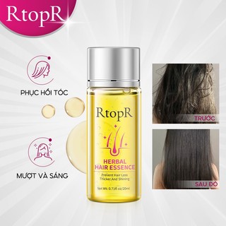 RtopR Tinh dầu dưỡng tóc ngăn rụng tóc 20ml
