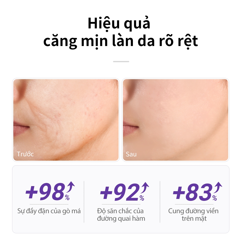 Serum Retinol Lanbena dưỡng ẩm làm mịn nếp nhăn hỗ trợ giảm mụn và làm săn chắc da 15ml