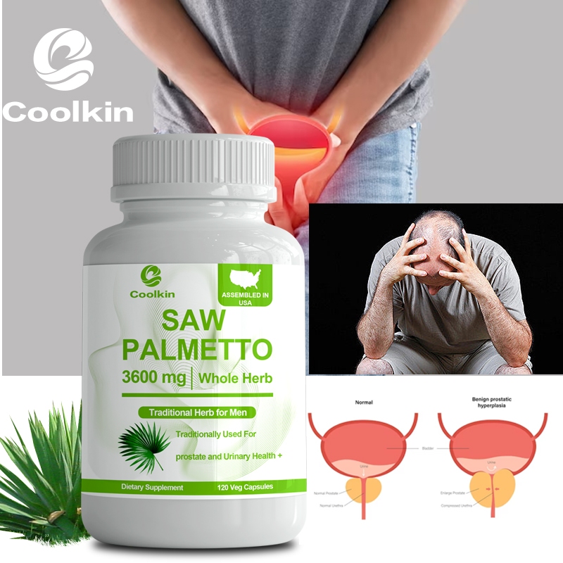 Sản xuất tại Mỹ - Saw Palmetto Extract 3600mg - Hàm lượng cao - Hỗ trợ sức khỏe tóc và tuyến tiền li