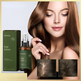Tinh dầu bưởi xịt kích thích mọc tóc chống rụng tóc