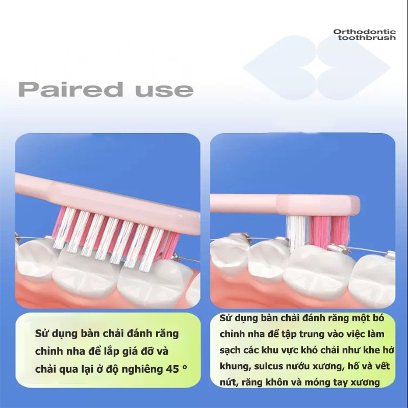 Airkiss Set 2 Bàn chải đánh răng chỉnh nha + bàn chải kẽ răng cụm đơn, thích hợp cho niềng răng