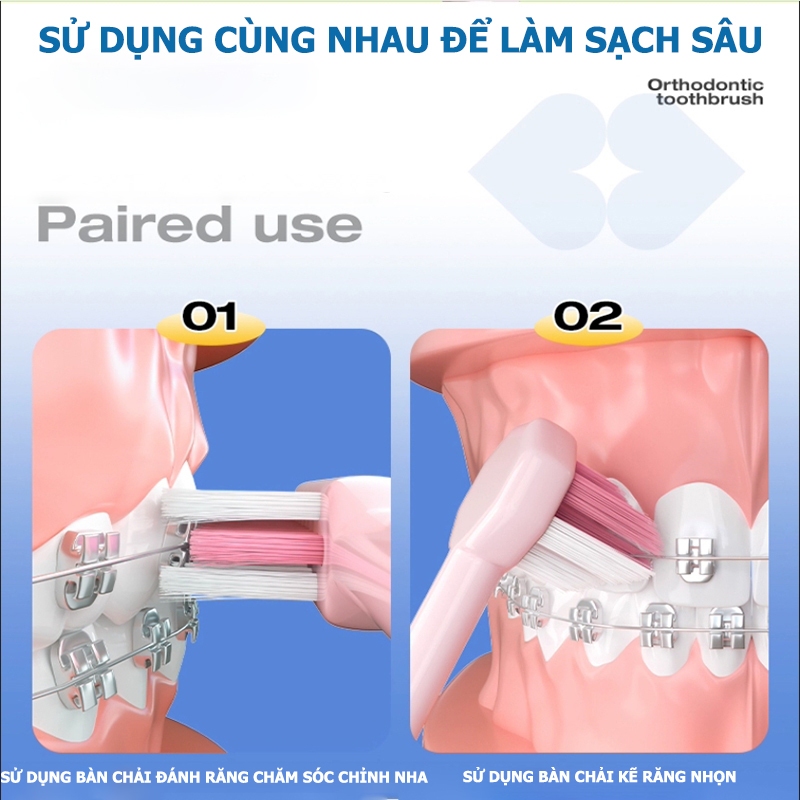 Airkiss Set 2 Bàn chải đánh răng chỉnh nha + bàn chải kẽ răng cụm đơn, thích hợp cho niềng răng