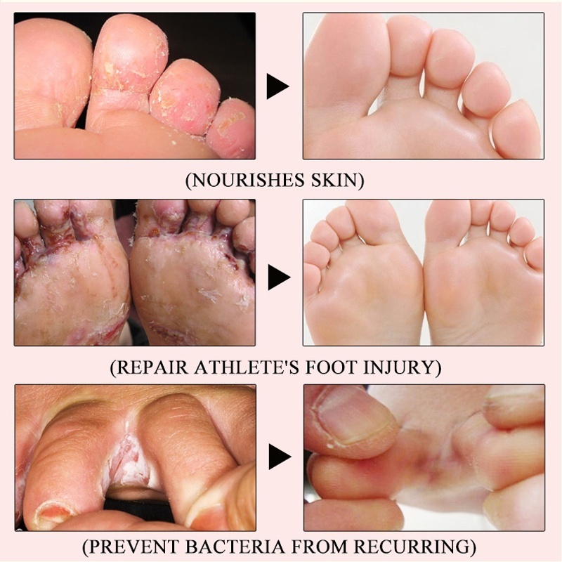 ⭐CHÍNH HÃNG⭐ kem trị nứt gót chân kem nứt gót chân kem bôi nứt gót chân Kem Dưỡng Ẩm Chống Nứt Nẻ Gót Chân 100ml Chống Nẻ Da Tay Chân á sừng Bong da Nứt Gót Chân Dưỡng Ẩm Làm Trắng Da