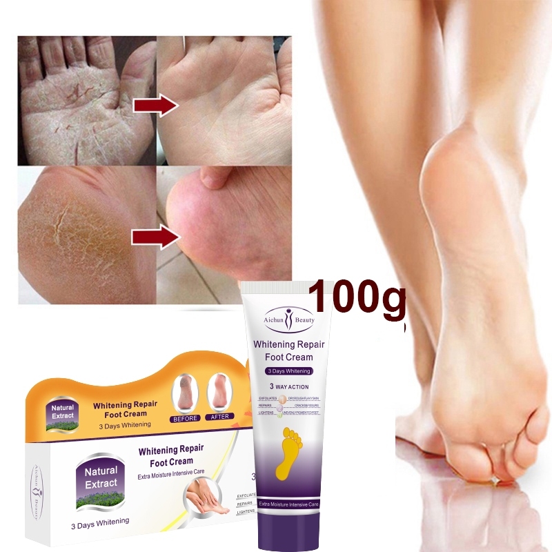 ⭐CHÍNH HÃNG⭐ kem trị nứt gót chân kem nứt gót chân kem bôi nứt gót chân Kem Dưỡng Ẩm Chống Nứt Nẻ Gót Chân 100ml Chống Nẻ Da Tay Chân á sừng Bong da Nứt Gót Chân Dưỡng Ẩm Làm Trắng Da
