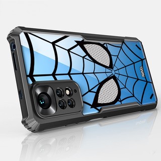 Ốp điện thoại Vỏ người nhện chống sốc Xiaomi Redmi Note 11 Pro Plus + 11S 11E 11T 2022 2021 4G 5G Vỏ Acrylic trong suốt