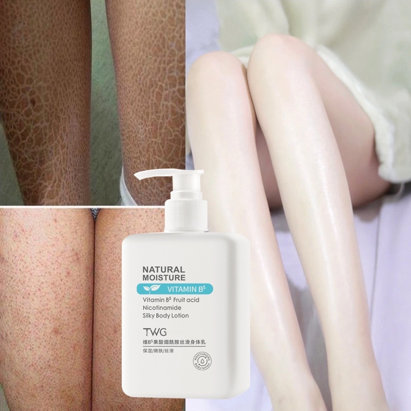 Kem dưỡng thể Niacinamide vitamin B5 Kem dưỡng trắng da toàn thân Dưỡng ẩm Làm sáng da 300ml làm trắng toàn thân mà không gây kích ứng, làm trắng da nhanh chóng