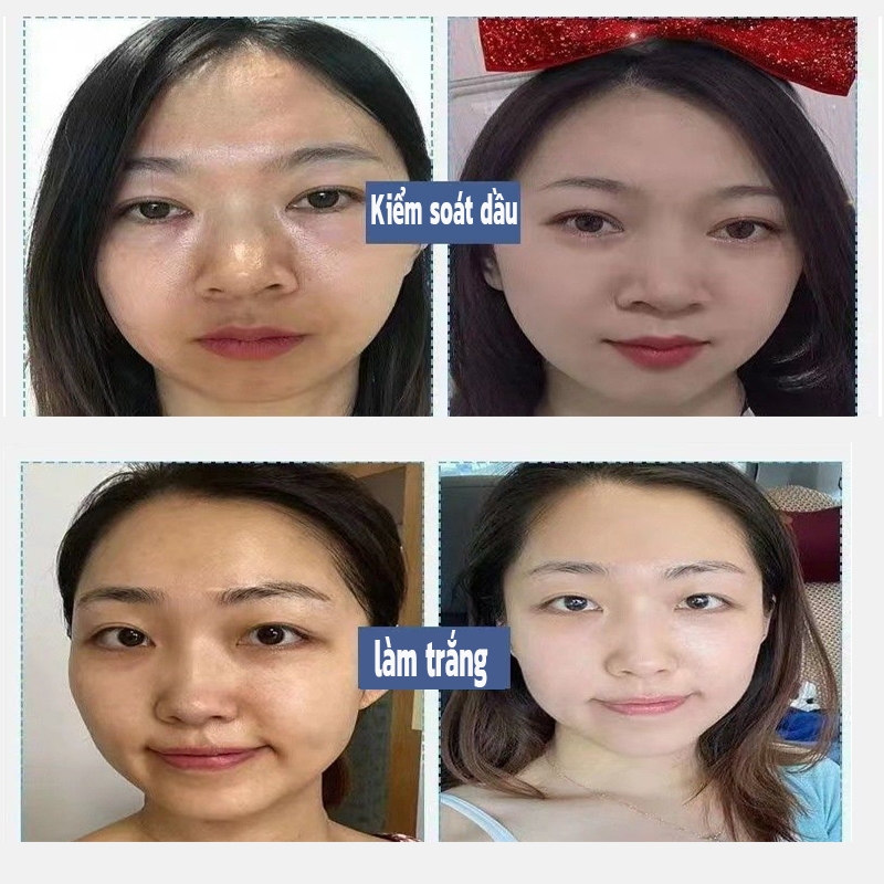 Sữa Rửa Mặt 377 WHITENING – Giải Pháp Toàn Diện Cho Da Sáng, Mụn, Tàn Nhang, Trẻ Hóa Da 100g