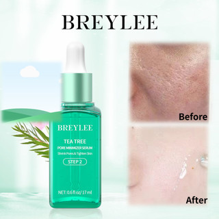 Serum se khít lỗ chân lông BREYLEE lột mụn đầu đen/giúp săn chắc da 17ml