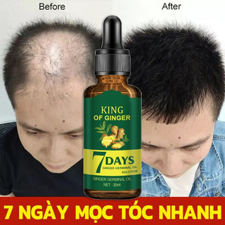 30ml Gừng Tăng Trưởng Tóc Tinh Chất Chống Rụng Tóc Gừng Lão Hóa Tóc Tăng Trưởng Nhanh Tóc Công Thức Chính Hãng Giải Pháp Tăng Trưởng Tóc Dầu Gừng