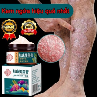 Kem chống ngứa kem kháng khuẩn chống dị ứng khỏi tận gốc viêm da bệnh chàm Ngứa da nấm da nấm mụn nước tổ đỉa 30g