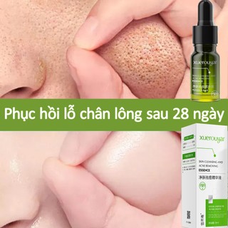 Serum se khít lỗ chân lông Sâu Thu Nhỏ Lỗ Chân Lông Cân Bằng Bã Nhờn Làm Sáng Da Da Săn Chắc Mịn Màng Dưỡng Ẩm 10ml