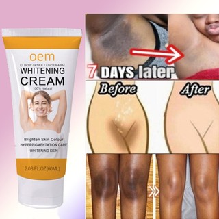 Kem làm trắng da Kem làm trắng có thể kem làm trắng nách 60g hiệu quả Làm trắng Vùng kín/đầu gối/khuỷu tay/dưới cánh tay/ cổ/bẹn làm trắng toàn thân giảm hắc tố