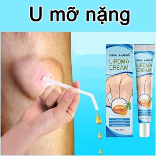 Kem tan u mỡ Tan u cứng U mỡ Kem u tuyến giáp 20g Kem tan mỡ chính hãng cho nhiều cục u dưới da đơn lẻ, u tuyến giáp, u mỡ dưới da dạng sợi
