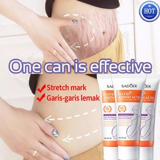 ⭐Chính Hãng⭐ Kem rạn daKem xoá rạn da sau sinh làm mờ vết thâm tăng độ đàn hồi cho da