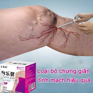 Kem suy giãn tĩnh mạch 20g giúp giảm đau mỏi tê phù chuột rút do suy giãn tĩnh mạch thúc đẩy tuần hoàn máu