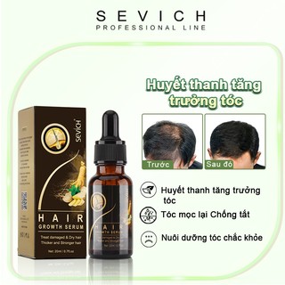 Tinh chất SEVICH chiết xuất gừng kích thích mọc tóc và chống rụng tóc tiện lợi 20ml